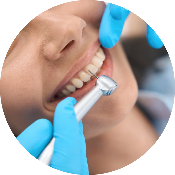 Chirurgie buccale : traitements au cabinet dentaire La Bastide à L'Isle-sur-la-Sorgue