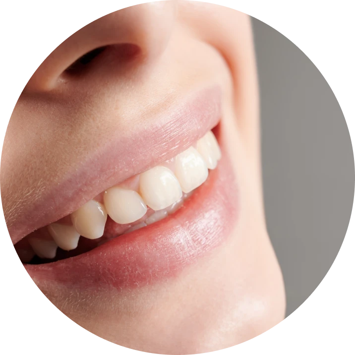 Esthétique : traitements au cabinet dentaire La Bastide à L'Isle-sur-la-Sorgue