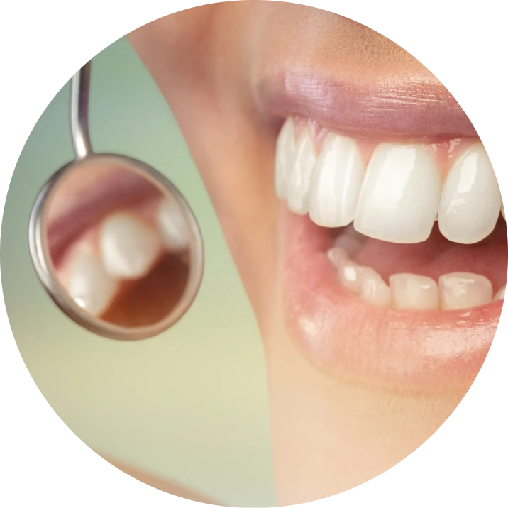 Parodontologie : traitements au cabinet dentaire La Bastide à L'Isle-sur-la-Sorgue