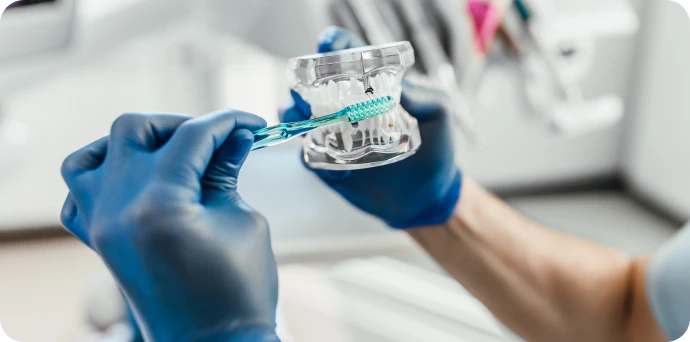 Conseils de brossage du cabinet dentaire La Bastide