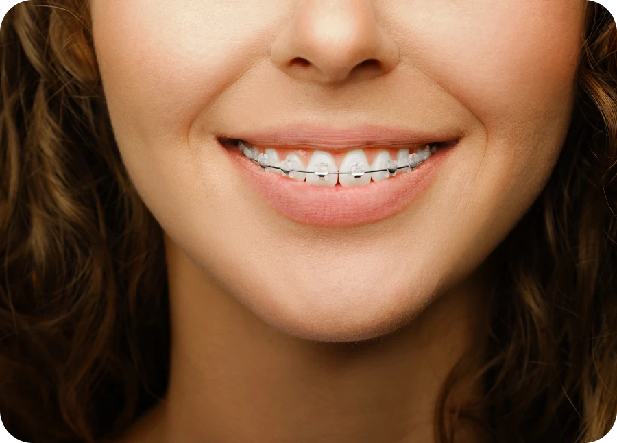 Multi-attaches au cabinet dentaire La Bastide à L'Isle-sur-la-Sorgue