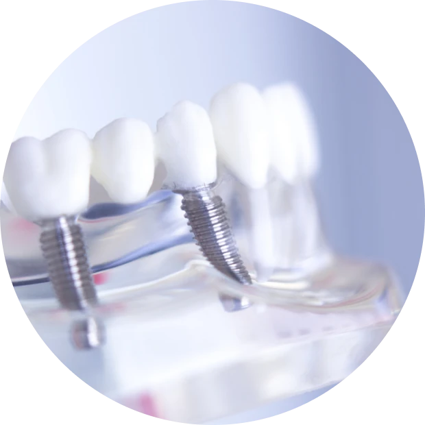 Prothèse dentaire : le cabinet dentaire La Bastide à L'Isle-sur-la-Sorgue